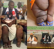  Santé : Le Sénégal célèbre une première journée mondiale du Lymphœdème et appelle à une prise en charge accessible 